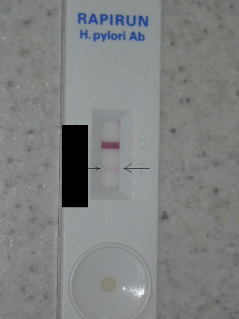 尿中抗 H. pylori 抗体測定法